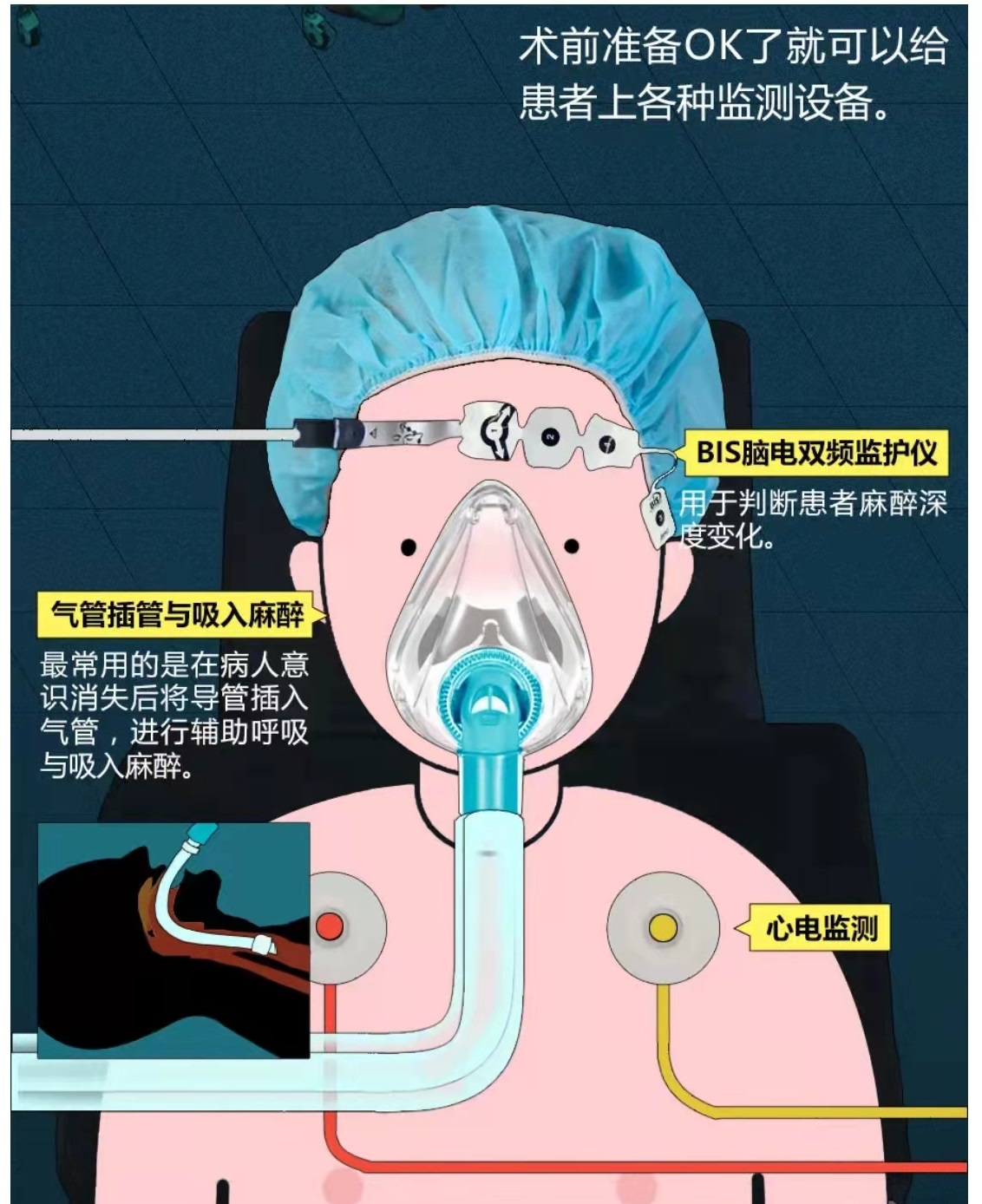 GE medical monitoring equipment of anesthesia department wire cable